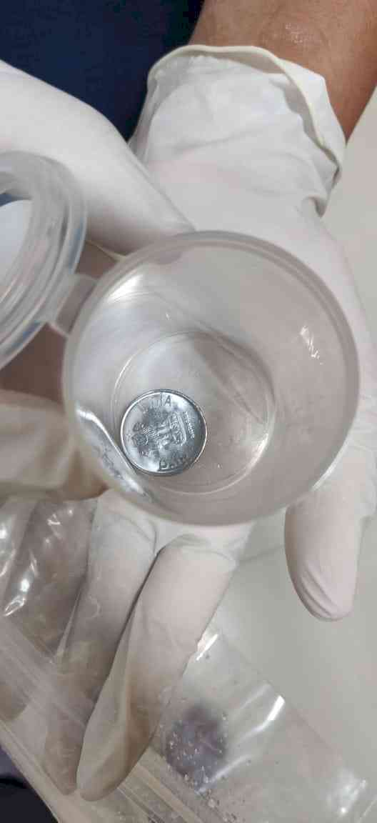 Doctors remove one-rupee coin from food pipe of eight-year-old boy