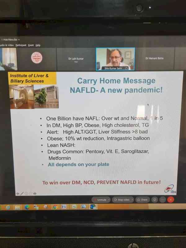 Webinar on non-alcoholic fatty liver disease- A new pandemic