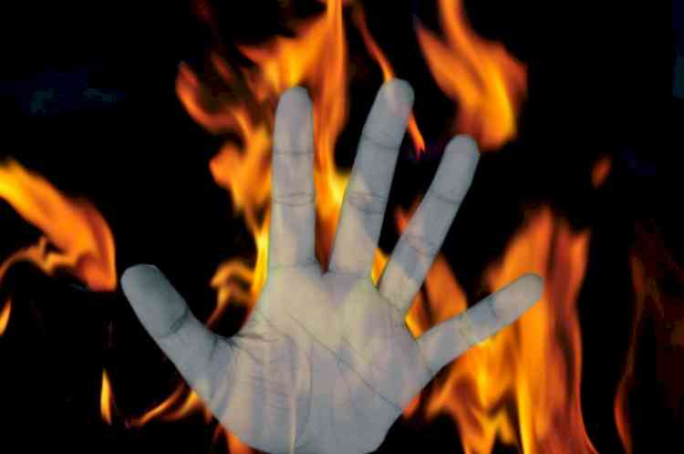 Woman set on fire for lodging molestation complaint