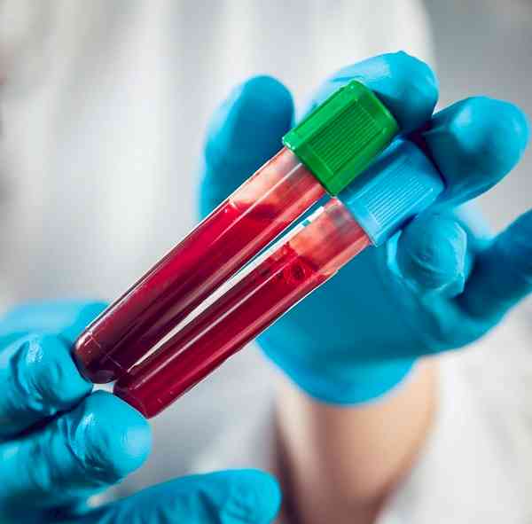India's top cancer facility, TMC Mumbai, appeals for blood