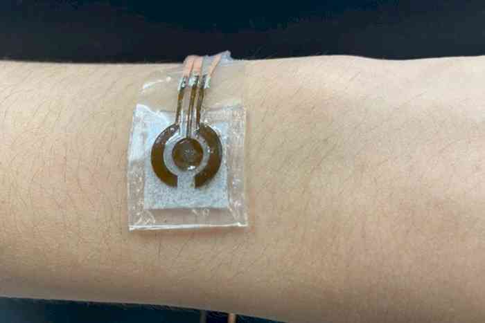 New wearable device uses sweat to monitor glucose levels