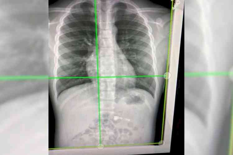 Rats chew up x-ray machine in Bihar hospital!