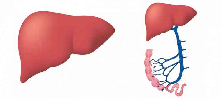 High fat diet, liquid fructose linked to fatty liver disease