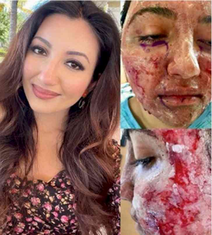 Indian-American Miss World 2021 first runner-up lives with pacemaker, survived facial burns