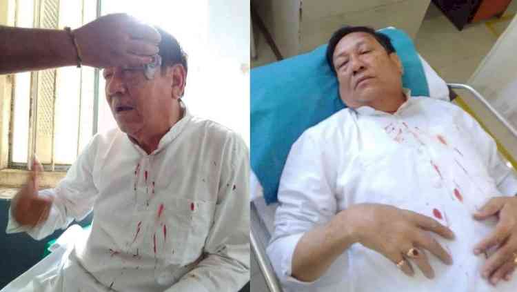 Tripura Cong chief among 20 injured in clash with BJP