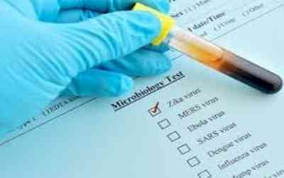 Maha: Cholera outbreak kills 5 in Amravati; 2nd Zika virus case detected in Palghar