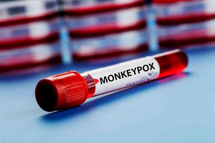 Delhi records second monkeypox case, nationwide tally reaches 6