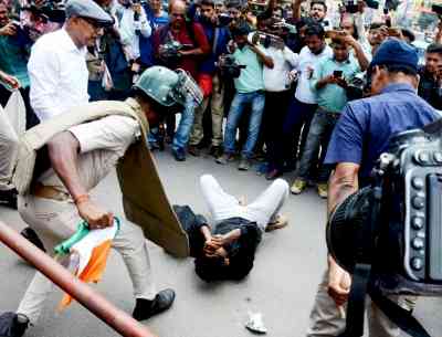 Patna: Condition of job aspirant injured in police lathicharge 'not well'