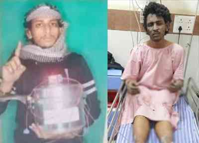 Mangaluru cooker blast case: Suspected terrorist discharged from hospital