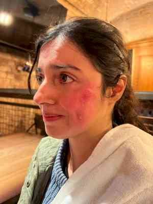 Divya Khosla Kumar gets injured while shooting for her upcoming project