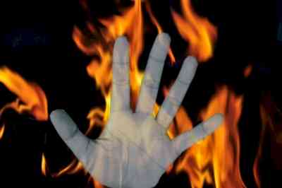 UP minor sets herself on fire after constant harassment by youth