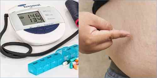 After diabetes and BP, obesity surge set off alarm bells across India