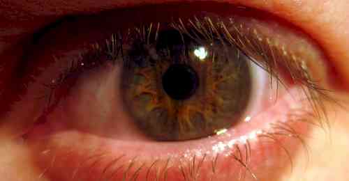 Delhi sees record rise in pink eye, dengue cases, say doctors