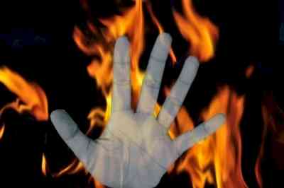 Raj businessman attempts self-immolation accusing govt of 'sheltering criminals'