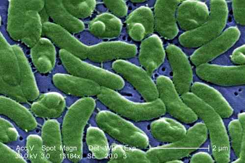 US woman loses all 4 limbs due to bacterial infection from fish