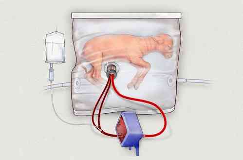‘Artificial wombs’ may soon see human trials: Report