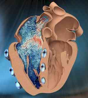 Indian-origin MIT engineer designs robotic replica of heart’s right chamber