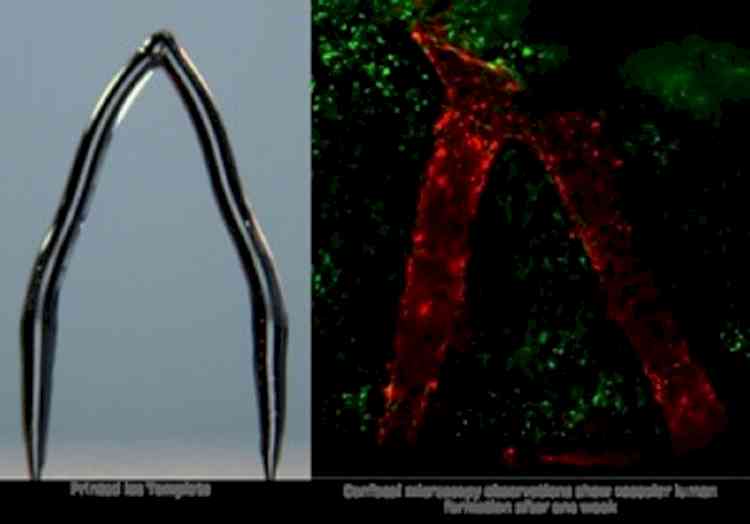 3D ice printing can create artificial blood vessels in engineered tissue