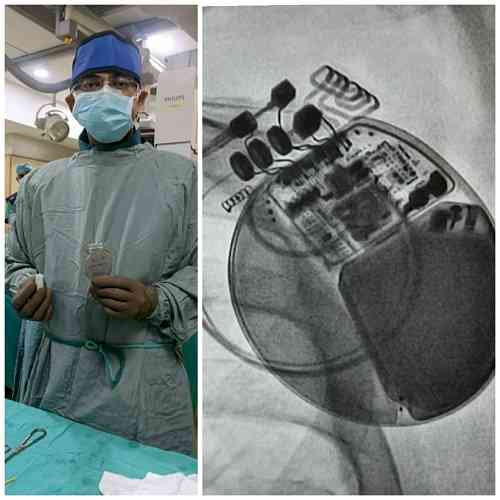 India’s First ‘Charisma Heart Failure Device’ successfully implanted in a 79-year-old patient at Fortis Jaipur