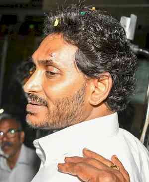 Vijayawada police file case of attempted murder for attack on CM Jagan Mohan Reddy