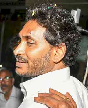 YSR Congress blames TDP for attack on Jagan