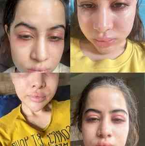Uorfi Javed clarifies she has ‘major allergies’ and hasn't gone ‘overboard with fillers’