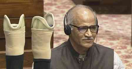 Uproar in RS as Sadanandan Master recalls brutal 1994 attack, displays prosthetics