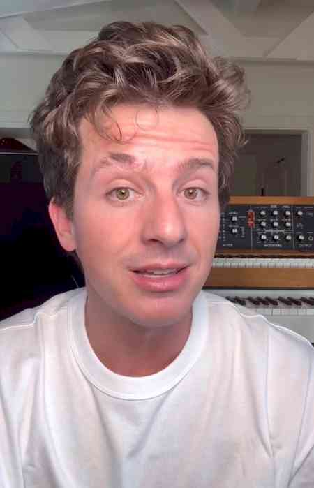 Charlie Puth says he is prone to getting sick over sounds