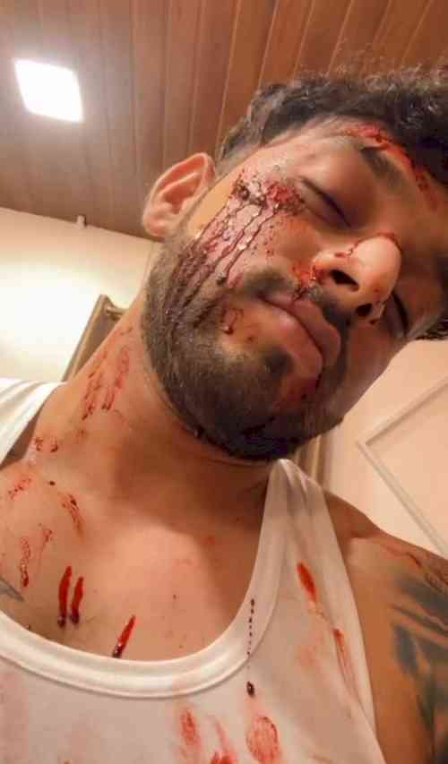 Shailesh Ramugade Steals the Spotlight in a Blood-Soaked Look